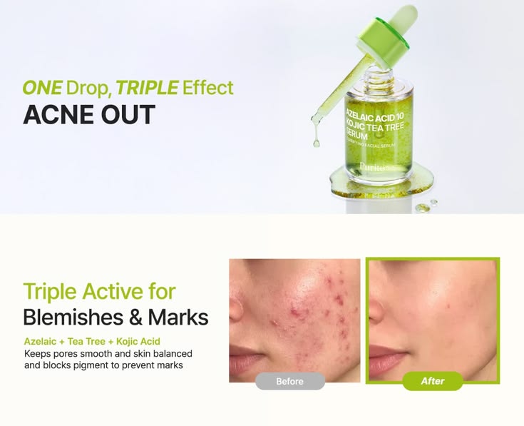 Purito SEOUL – Azelaic Acid 10 Kojic Tea Tree Serum