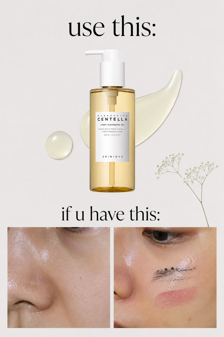 SKIN1004 – Madagascar Centella Light Cleansing Oil